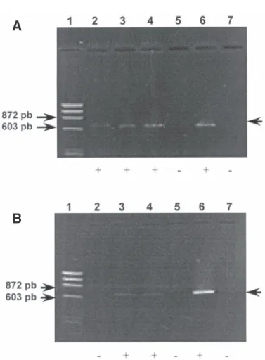 Fig. 2 - Electrophoresis profile on 1% agarose gels of PCR products after DNA amplification of test samples with complex-specific primers