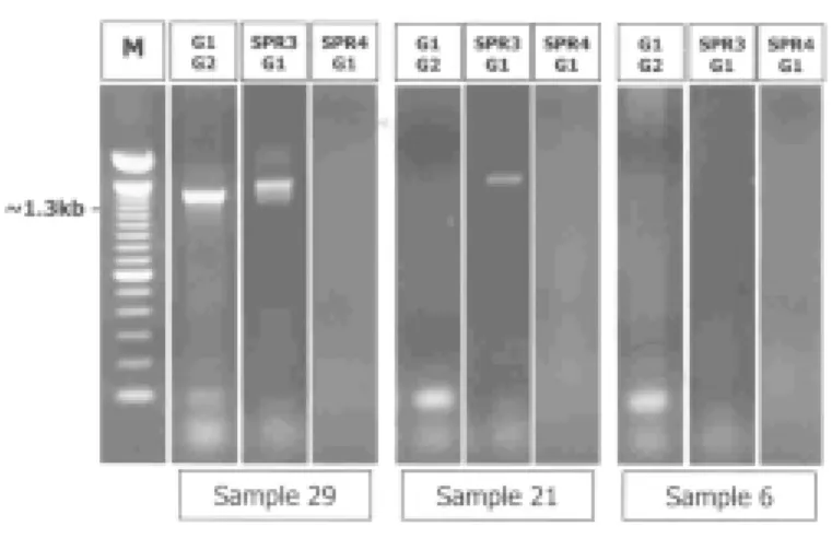 Fig. 4 - PCR for B. cepacia complex genomovar determination, as described by WHITBY et al