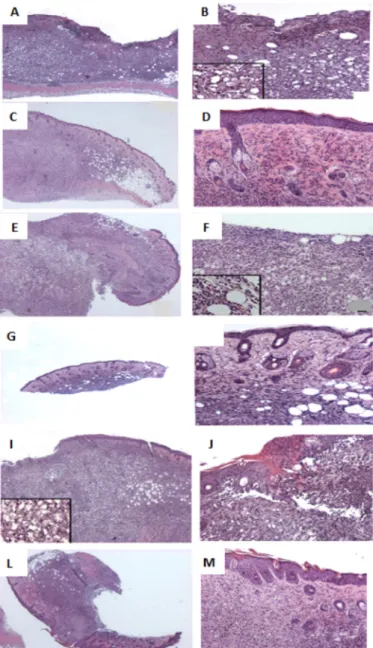 Fig. 5 - INF-γ production in BALB/c mice infected with L. amazonensis and treated with  glucantime, propain or exposure to HBO