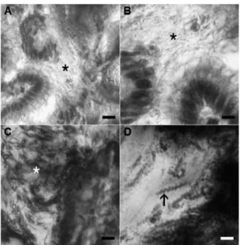 Fig. 2 - Gastric mucosa (fundus) biopsy sections. (A) Gastric tissue section stained by H&amp;E  showing  massive  presence  of  spiral-shaped  bacteria  in  the  gastric  mucosa  (asterisk)