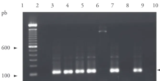 Figure 2. Nested PCR (nPCR) of T. equi DNA isolated from blood  of naturally infected horses raised in the Jaboticabal microregion,  São  Paulo  State,  Brazil