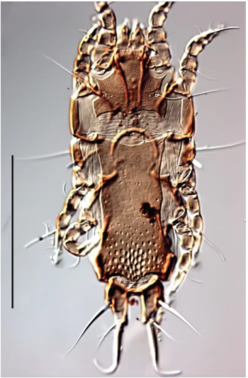 Figure 4. Anisophyllodes elaeniae: Female. 