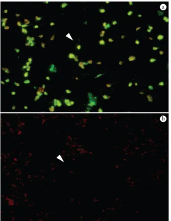 Figure 5. Fluorescence patterns of IFAT using L. infantum chagasi  amastigote and promastigote forms as antigen