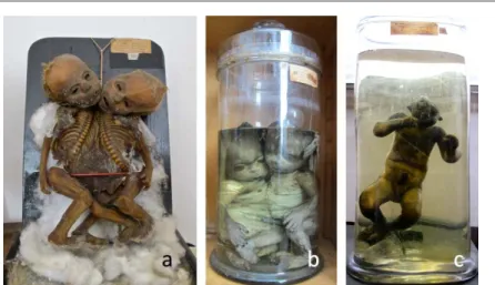 Figura 3. Fotografias actuais de possíveis “Monstros” de Vandelli no Museu de  Anatomia Patológica da FMUC