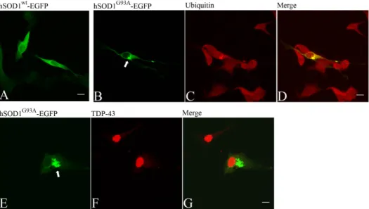 Figure  15:  Immunofluorescence  microscopy  of  mutant  SOD1 G93A 'EGFP  aggregates  in  NSC'34  cells