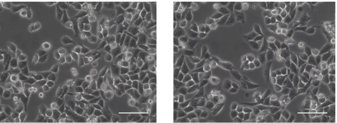 Figure 3.1  –  Optical microscopy visualization of OVMz cells. The scale bar corresponds to 100 µm