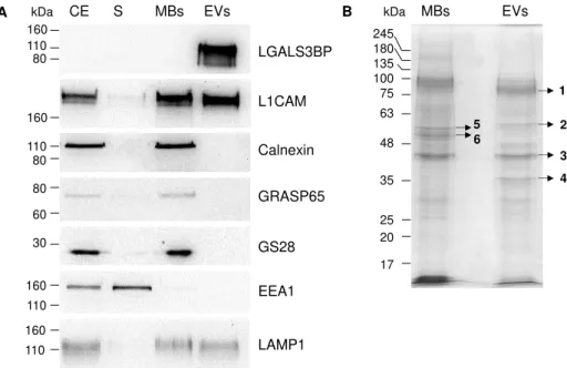 Figure 3.5  –  Comparison of protein profiles of MBs and EVs from OVMz cells. (A) Immunoblotting  of cellular extracts (CE), post-100000xg supernatant from MBs isolation (S), MBs and EVs