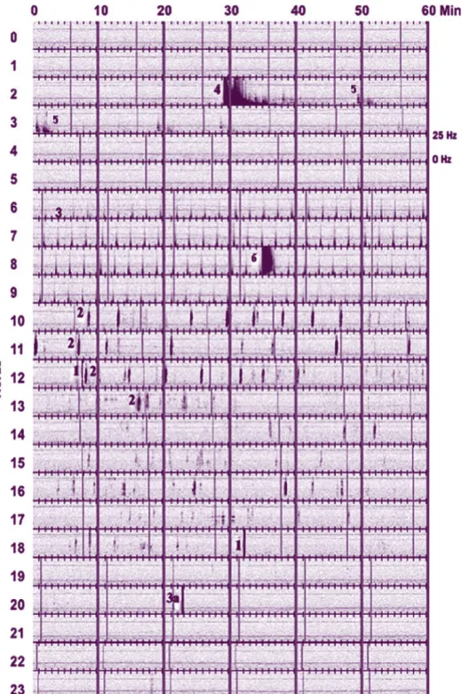 fig. 4 Espectograma virtual diário, criado  para exemplificar numa só imagem os 6  tipos de sinais detectados