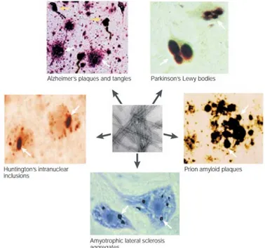 Figure 1.1. The formation of protein aggregates constitutes a common hallmark of  human neurodegenerative diseases