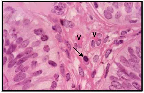 Figura 18 B: Fotomicrografia mostrando a lâmina própria  da tuba uterina com vasos sangüíneos (V) e um plasmócito  (seta)