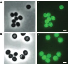 Figure  7  -  Microscopy of COLmecA7_K cells exposed to 0 µg/ml (A) or 500 µg/ml of oxacillin (B)