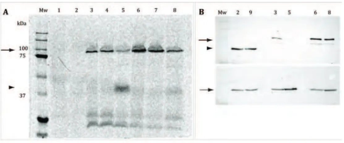 Figure 9 –  Analysis of cell extracts expressing GFP-PBP2A by GFP fluorescence detection (A) and Western  Blot (B) using anti-PBP2A antibody (upper panel) or anti-PBP2 antibody (lower panel)