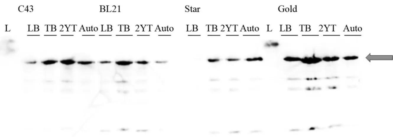 Figure 4.15 - Western Blot to evaluate ArlS expression tests in E. coli at 37ºC. C43- C43 strain, BL21 –BL21  strain, Star - Bl21 Star strain, Gold - BL21 Gold strain; LB – LB broth medium, TB – TB medium, 2YT – 2xYT  medium, Auto  –  Autoinduction medium,