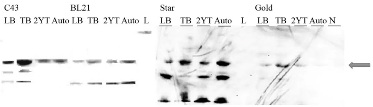 Figure 4.19 - Western blot to evaluate BceS expression tests in E. coli at 37ºC. C43, BL21, BL21 Star and  BL21 Gold – tested strains