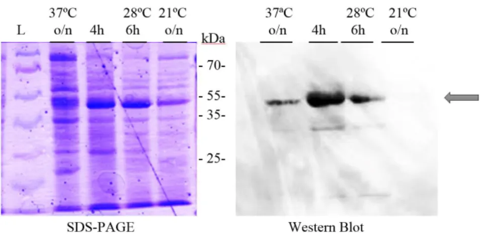 Figure  4.22  –  10% SDS-PAGE and Western Blot  to analyse ArlS expression tests  in E