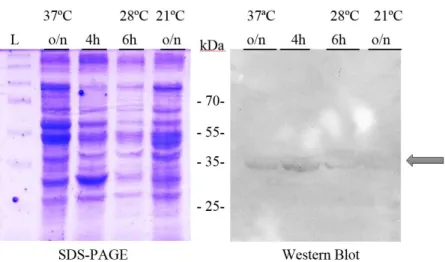 Figure  4.23  –  10% SDS-PAGE and Western Blot  to analyse BceS expression tests in  E