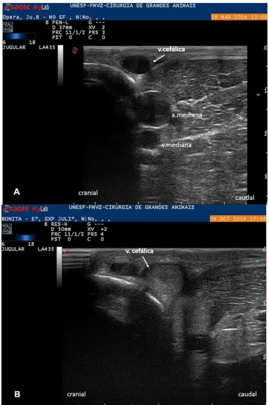 FIGURA 9 – Imagem ultrassonográfica da veia cefálica no momento prévio aos  procedimentos cirúrgicos (M-24h)