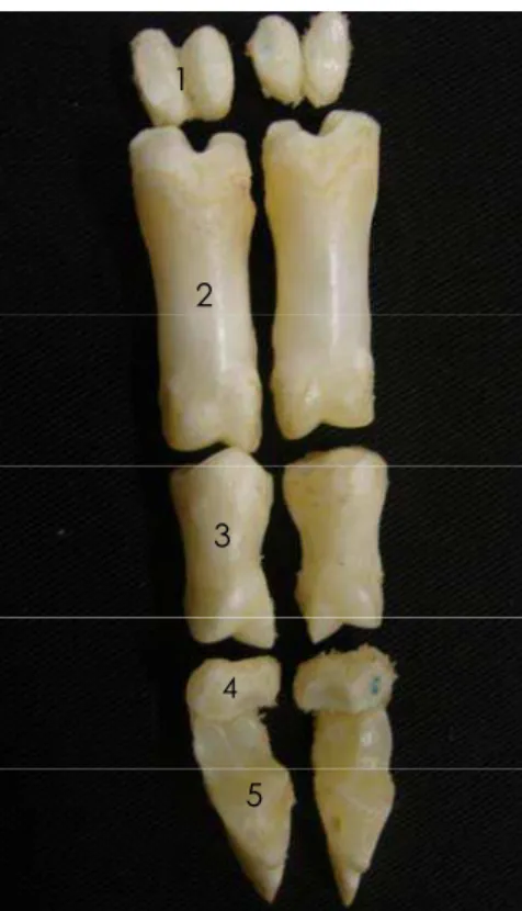 Figura 6. Vista dorsal (A) das falanges e sesamóides do III e IV dedos de um ovino.                 Destacam-se os ossos: sesamóides proximais (1), falanges proximais (2),                 falanges médias (3), sesamóides distais (4) e falanges distais (5)