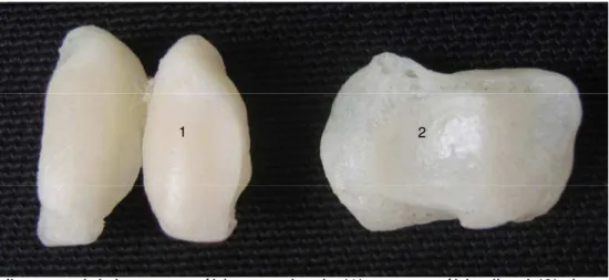 Figura 10. Vista cranial dos sesamóides proximais (1) e sesamóide distal (2) de um                   ovino