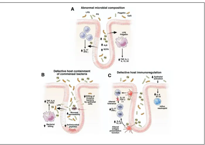 Figure 1.3  –  Potential mechanism by which SRB induce chronic inflammation in IBD. (A) Intestinal dysbiosis in  inflammatory bowel diseases is caused by decrease of putative beneficial bacteria and increase in detrimental bacteria  like SRB