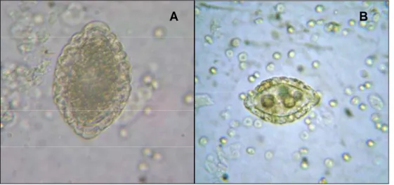 Figura 2.1. Ovos de Dioctophyme renale em urinas de cães naturalmente parasitados. 