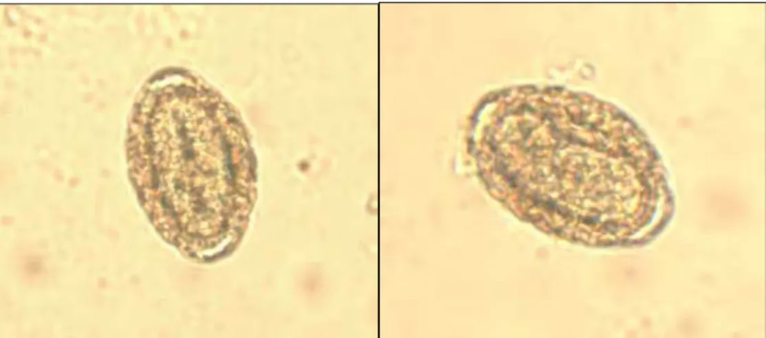 Figura  2.4.  Ovos  larvados  de  Dioctophyme  renale  aos  18  dias  de  incubação  (aumento  de  200x)