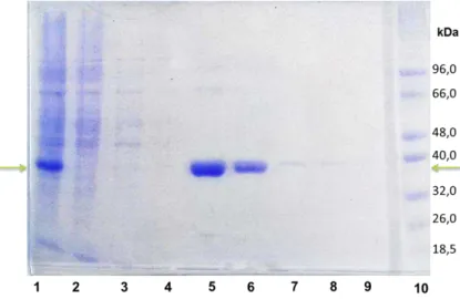 Figure  13 -  Purification  of  ATL-C  recombinant  His-tagged  protein.  Lane  1: total extraction  lysate; 