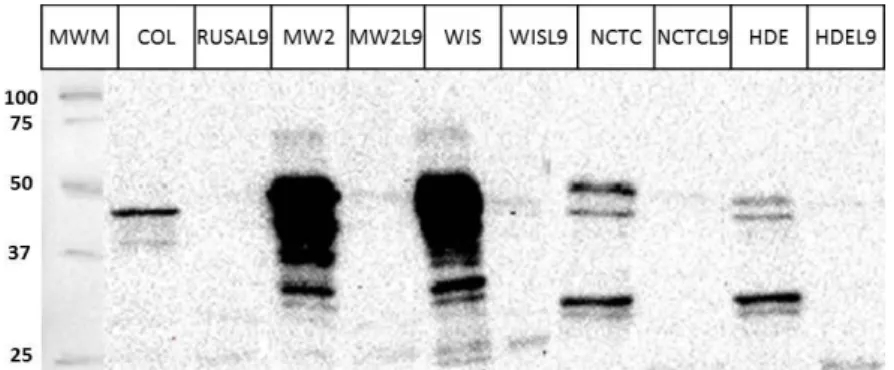 Figure  19  – Detection  of  GL  protein  performed  by  Western  Blot  using  anti-GL  raised  antibody  against cellular extracts of different strains and their respective isogenic atl mutants