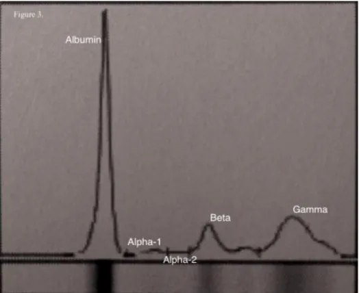 Figure 9. Representative serum protein electrophoretogram in ewe between 3 and 5 years old