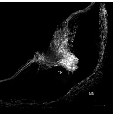 Figure 5. 2D maximum intensity projection of sensory neurons  associated with palpal organ in the synganglion of a male Amblyomma  americanum showing several bulges