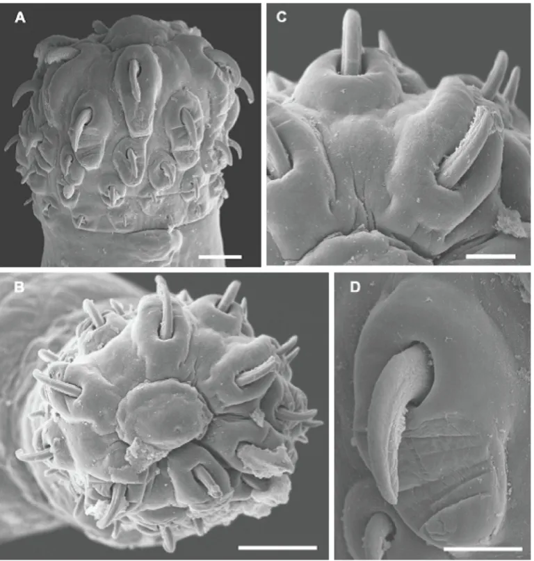 Figure 2. Scanning Electron Microscopy of an Oligacanthorhynchidae cystacanth proboscis found in the visceral peritoneum of Ameiva ameiva  ameiva