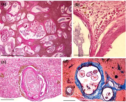 Figure 2. Histological sections of cyst-nematodes in Gymnotus inaequilabiatus. (a) Cysts structures widespread in liver parenchyma