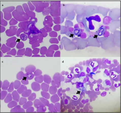 Figure 1. Peripheral blood smears from dogs naturally infected by piroplasms: (a, b, c) arrows indicating intraerythrocytic Rangelia vitalii  merozoites (diagnosed by means of PCR and sequencing) from naturally infected dogs; (d) arrow indicating R