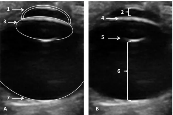 FIGURA  3:  Imagem  ultrassonográfica  do  bulbo  ocular  direito,  do  animal  de  número  nove  (A9),  obtida  no  plano  sagital