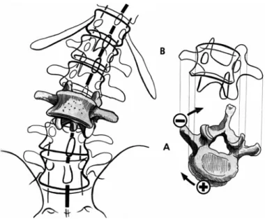 Figura 2.9 – Rotação automática da vértebra em flexão lateral (KAPANDJI, 2000, p. 45)