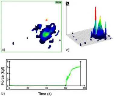 Figure 7 - Image of the walking pressure resultant from bird number 30 with gait score 1 (a), software output of the equivalent MaxGRF display in three dimensions (b), and its distribution during locomotion (c).Figure 5 - Image of the walking pressure resu
