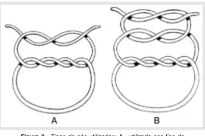 Figure 3 - Types of knots employed: A  knot employed for polypropylene  monofilament  threads;  B    knot  employed  for  nylon