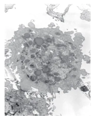 Fig. 2 - Micrograph of apoptotic hepatocyte invaded by Listeria monocytogenes;