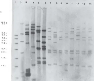 Fig. 1 - Ribotyping representative of F. nucleatum/EcoRI. Autoradiogram of Southern blot hybridized with pKK3535 probe and washed with 20 X SSC for two h, 15 min., at 65  o C