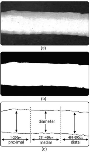 Figure 2 depicts an image of a trachea in the CONTROL group, showing the result of image segmentation using the Otsu technique for determining the optimal threshold (11) and showing how the percentage change in the tracheal