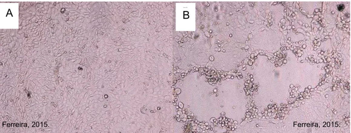 FIGURA  11-  (A)  Controle  negativo  –  célula  Vero  40x;  (B)  Efeito  citopático  padrão (ECP) - Orf vírus em células Vero 40x