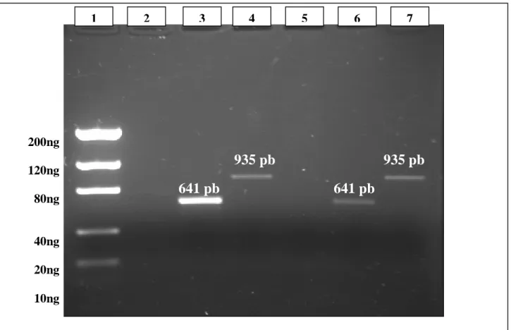 Figura 3. Representação em gel de agarose (2%) da concentração de amplicons 