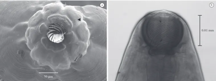 Figure 1. Micrographs of Procamallanus (Spirocamallanus) inopinatus: A – SEM micrograph of anterior end, apical view showing four cephalic  papillae (black arrow)