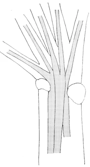 FIGURA 9B.  Esquema del patrón L correspondiente a Liolaemus (con placa tendinosa).