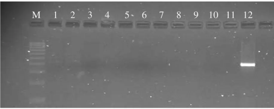 Figura 7 - Resultados após electroforese dos produtos da reacção de PCR (M – marcador de 100 pares de bases; linha 1  – amostra S23, com resultado positivo; linha 2 – amostra S61, com resultado positivo; linhas 3 a 10 – amostras S59, 