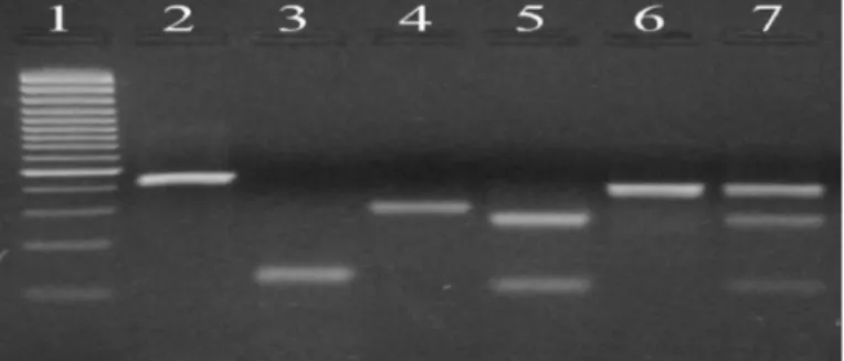 Figura 2.4 – Identificação de espécies e formas moleculares do complexo An. gambiae, por PCR-RFLP