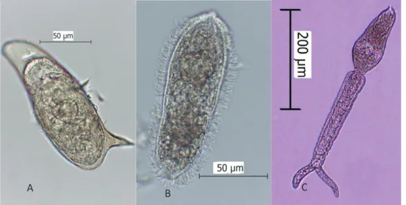 Figura 2 – A) Ovo de  Schistosoma mansoni;  B) Miracídio de  S. mansoni ; C) Cercária de  S