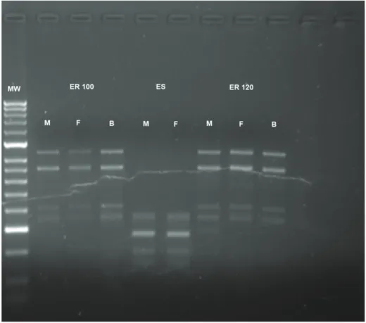 Figura 6  – RAPD-PCR, OPI-5. MW – marcador molecular 2000 bp; ER 100 - Estirpe  resistente a 100 mg/kg de Praziquantel; ES - Estirpe sensível a PZQ; ER 120 - Estirpe  resistente a 120 mg/kg de Praziquantel