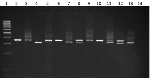 Figura 11 – Padrão de bandas numa eletroforese obtidas pelo PIRA-PCR na deteção de  mutações  kdr