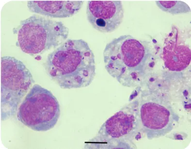 Figure 11  THP-1 derived macrophages infected with a 5 day old culture of metacyclic  promastigotes of  L